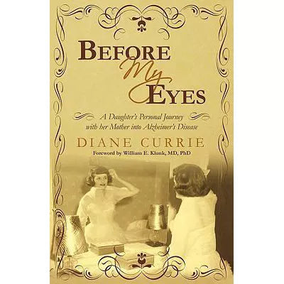 Before My Eyes